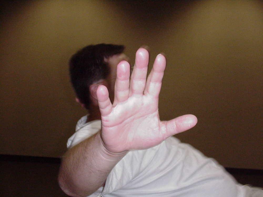 dan's hand